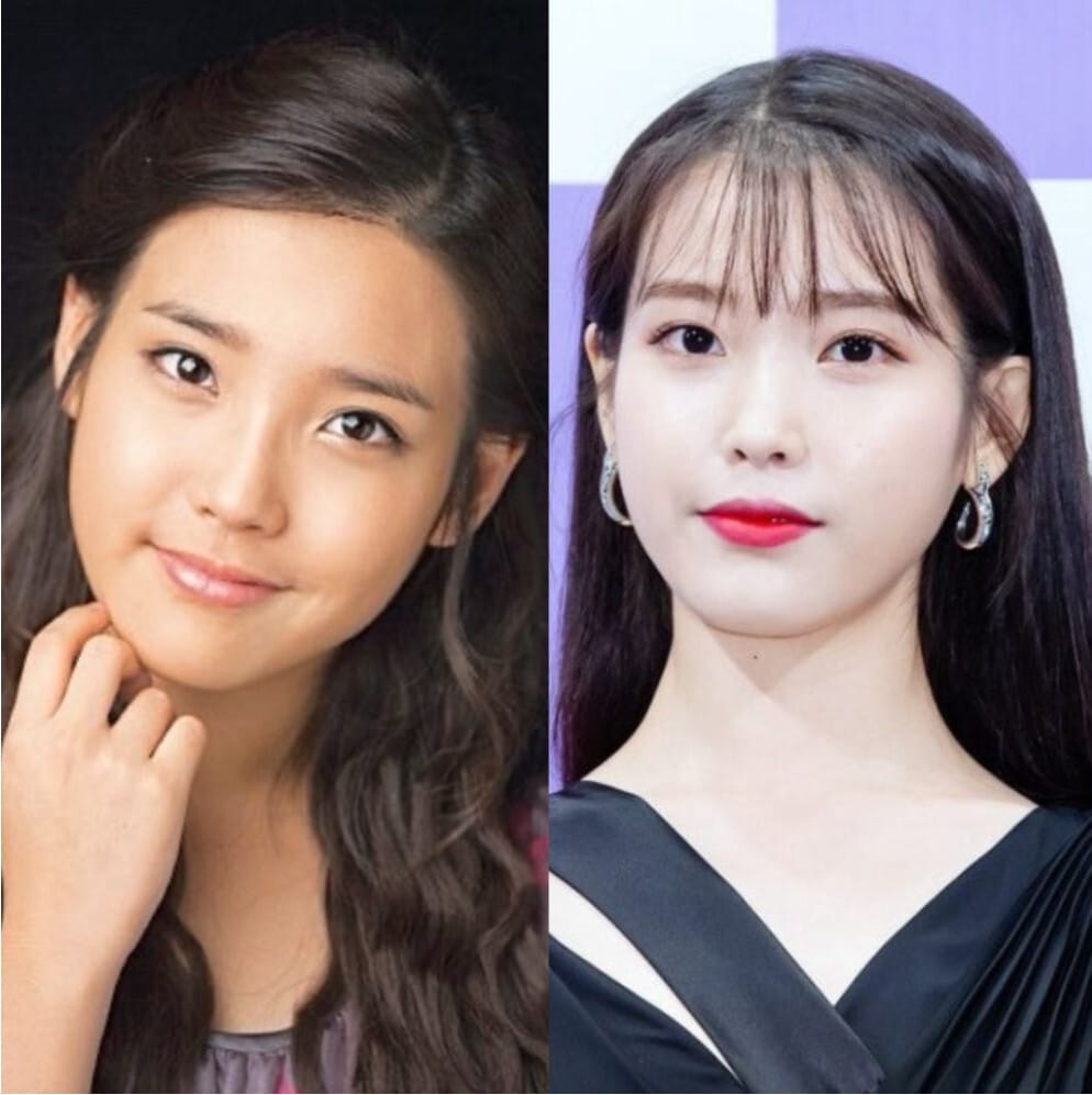 IU Glow: Safe Korean Skin Brightening & Science Guide